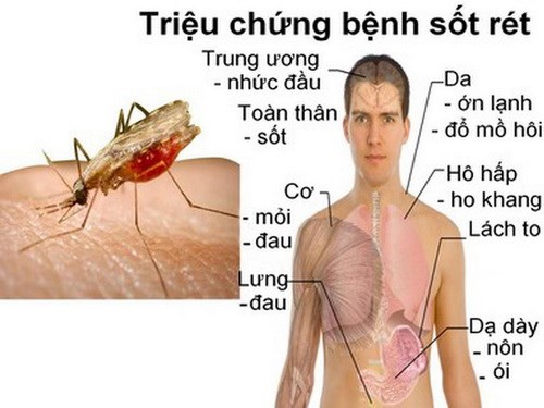 Cách phòng chống muỗi đốt (chích)